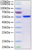 Recombinant SARS-CoV-2 Nucleocapsid (N) Protein (CARP01264)