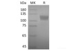 SARS-CoV-2 Spike S1 Recombinant Protein (RPES0017)