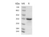 2019-nCoV Papain-like Protease Recombinant Protein (RPES0056)
