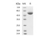 2019-nCoV Spike Recombinant Protein (RPES0067)
