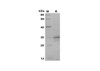 Recombinant Monkey CT Protein(Gst Tag) (RPES8001)