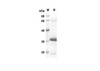 Recombinant Human BMP-2 Protein(Sumo Tag) (RPES8014)