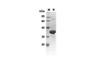 Recombinant Human CASP7 Protein(Sumo Tag) (RPES8022)