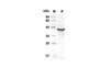 Recombinant Human GLI1 Protein(Trx Tag) (RPES8025)