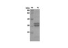 Recombinant Human IL-15 Protein(Sumo Tag) (RPES8098)