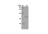 Recombinant Human GNLY Protein(Trx Tag) (RPES8099)