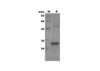 Recombinant Human CCL14a/HCC-1 Protein(Sumo Tag) (RPES8102)