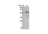 Recombinant Human BMP-7 Protein(Gst Tag) (RPES8112)