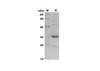 Recombinant Mouse CCL2/JE/MCP-1 Protein(Trx Tag) (RPES8175)
