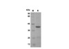 Recombinant Mouse Lymphotoxin-Â±/TNF-Â² Protein(Sumo Tag) (RPES8181)
