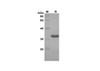 Recombinant Mouse Galectin-7 Protein(Trx Tag) (RPES8183)