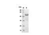 Recombinant Mouse Galectin-7 Protein(Gst Tag) (RPES8184)