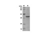Recombinant Mouse BMP-9 Protein(Trx Tag) (RPES8189)