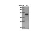 Recombinant Mouse IL-17D Protein(Sumo Tag) (RPES8197)
