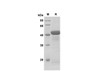 Recombinant Mouse IL-27 Protein(Sumo Tag) (RPES8200)