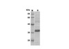 Recombinant Mouse LY6G Protein(Trx Tag) (RPES8201)