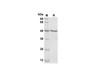 Recombinant Mouse CXCL1/Lymphotactin1/I-TAC Protein(Gst Tag) (RPES8207)