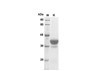 Recombinant Mouse IL-3 Protein(Trx Tag) (RPES8216)