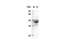Recombinant Rat CXCI3 Protein(Gst Tag) (RPES8220)