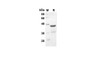 Recombinant Rat Cxcl2 Protein(Gst Tag) (RPES8227)
