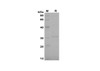 Recombinant Rat CCL20/MIP-3Â± Protein(Trx Tag) (RPES8246)