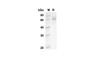 Recombinant Human PSAP Protein(His Tag) (RPES8259)