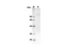 Recombinant Human CD36 Protein(Fc Tag) (RPES8287)