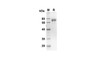 Recombinant Human PTX3 Protein(Fc Tag) (RPES8288)