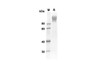 Recombinant Human CD6 Protein (Fc Tag) (RPES8298)