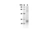 Recombinant Human ACVRL1 Protein (His Tag) (RPES8303)