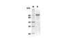 Recombinant Human SEMA3A Protein (Fc Tag) (RPES8304)