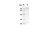 Recombinant Human GPNMB Protein (His Tag) (RPES8311)