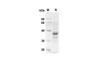 Recombinant human CCL3 Protein (Fc Tag) (RPES8314)