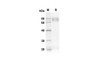 Recombinant Human CD80 Protein (Fc Tag) (RPES8318)