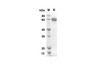 Recombinant Human IL2RA Protein (Fc Tag) (RPES8321)