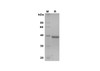 Recombinant Human SPARC Protein (His Tag) (RPES8368)