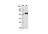 Recombinant Human GITR/TNFRSF18 Protein (Fc Tag) (RPES8378)