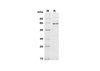 Recombinant Human Kallikrein 3/PSA Protein (Fc Tag) (RPES8384)