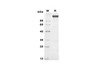 Recombinant Human APN Protein (Fc Tag) (RPES8388)