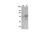 Recombinant Human M-CSF Protein (His Tag) (RPES8391)