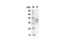 Recombinant Mouse IL17R Protein (His Tag) (RPES8409)