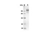 Recombinant Mouse CD6 Protein (Fc Tag) (RPES8428)
