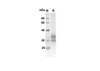 Recombinant Mouse Tnfrsf9 Protein (His Tag) (RPES8429)