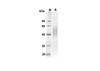 Recombinant Mouse CD244 Protein (His Tag) (RPES8431)