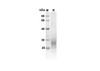 Recombinant Mouse ACVRL1 Protein (His Tag) (RPES8433)