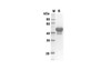Recombinant Mouse IL-23A Protein (Fc Tag) (RPES8434)