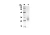 Recombinant Mouse Ctla4 Protein (His Tag) (RPES8437)