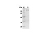 Recombinant Mouse AXL/UFO Protein ( Fc Tag) (RPES8450)
