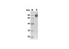 Recombinant Mouse CA9 Protein ( Fc Tag) (RPES8452)