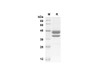 Recombinant Mouse CCL1 Protein ( Fc Tag) (RPES8456)